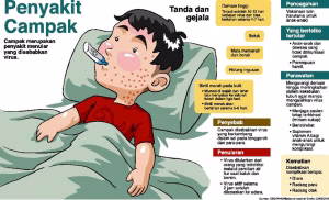 “Waspada Campak: Ancaman Serius bagi Anak dan Cara Mencegahnya”