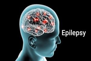 epilepsy_1669200022