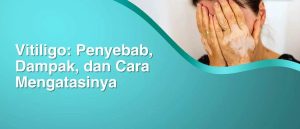 “Vitiligo: Penyebab, Risiko, dan Fakta Medis yang Wajib Diketahui Masyarakat”