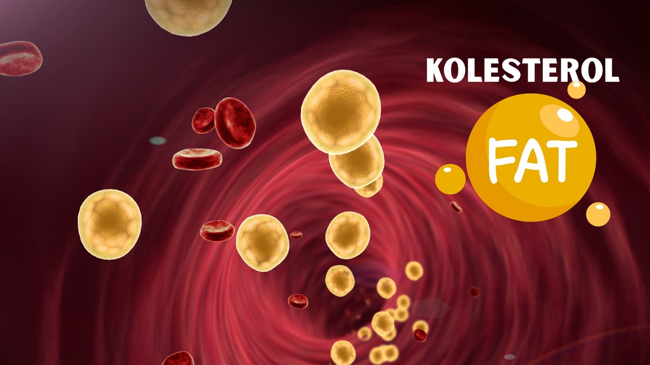 Kolesterol Tinggi Mengancam Kesehatan, Kenali Penyebabnya