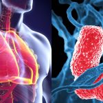 Waspada Paru-Paru Basah: Penyebab, Gejala, dan Risiko Kematian