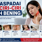 Jangan Sepelekan! Tanda Awal Kanker Getah Bening