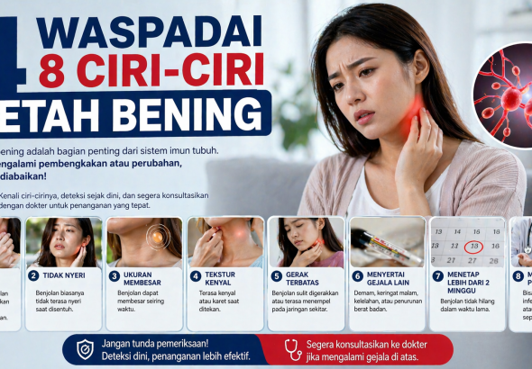 Jangan Sepelekan! Tanda Awal Kanker Getah Bening