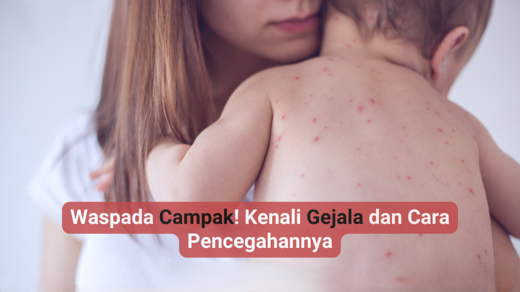 Dari Ruam ke Telinga: Dampak Campak yang Jarang Disadari