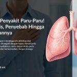 Paru-Paru Bermasalah? Kenali Tanda-Tandanya Sejak Dini