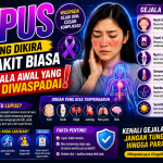 Gejala Awal Lupus Sering Dianggap Masuk Angin, Ini Faktanya