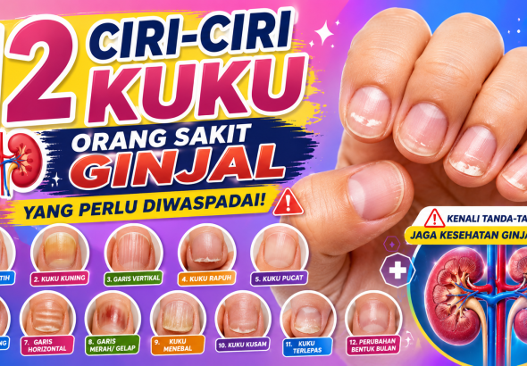 Jangan Abaikan, Ini 12 Perubahan Kuku yang Bisa Berkaitan dengan Gangguan Ginjal