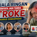 Waspada Sebelum Terlambat, Kenali 5 Gejala Stroke yang Kerap Terlewatkan