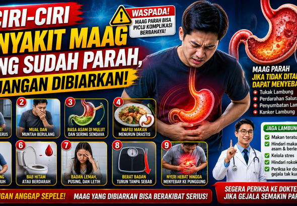 Maag Parah Bisa Memicu Komplikasi, Ini Gejala yang Harus Diwaspadai