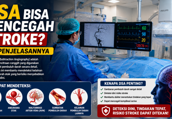 DSA Bukan Sekadar Pemeriksaan, Bisa Membantu Mencegah Stroke Serius