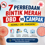 Kenali Gejalanya! 7 Perbedaan DBD dan Campak yang Tidak Boleh Diabaikan