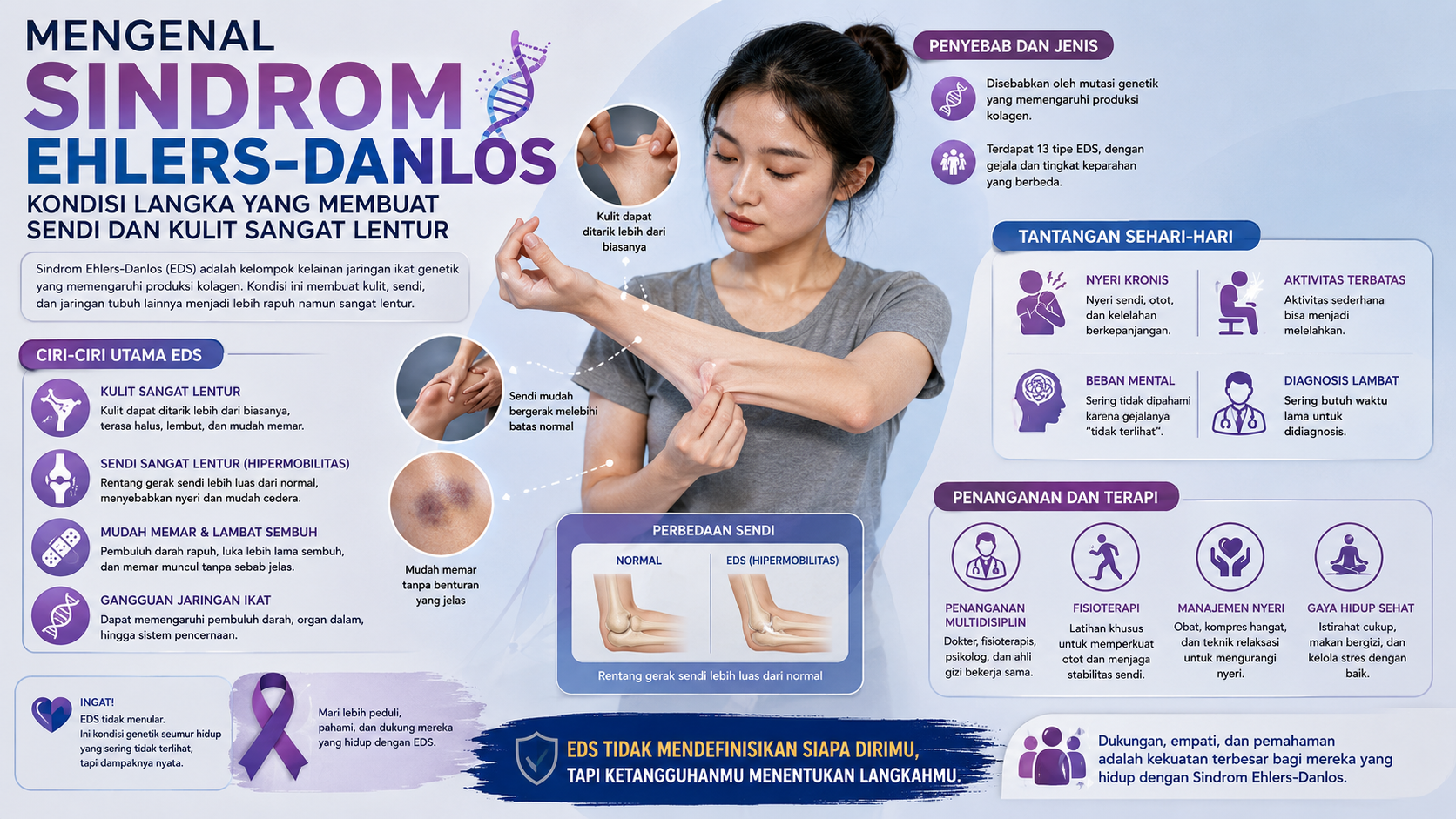Apa Itu Sindrom Ehlers-Danlos? Kondisi Langka yang Memengaruhi Kulit dan Sendi