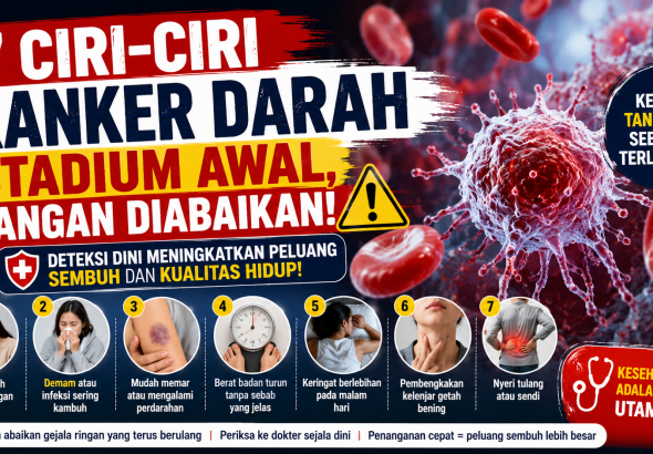7 Ciri-Ciri Kanker Darah Stadium Awal