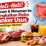 Wajib Tahu! 5 Makanan dan Minuman yang Perlu Dibatasi untuk Menjaga Kesehatan Usus