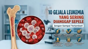 gejala leukemia