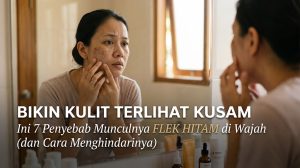 penyebab flek hitam di wajah