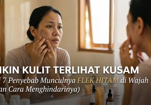 penyebab flek hitam di wajah